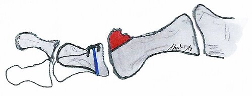 cme_abb_11.jpg cme_abb_11.jpg