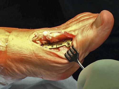 cme_abb_14.jpg cme_abb_14.jpg