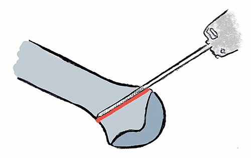 cme_abb_16.jpg cme_abb_16.jpg