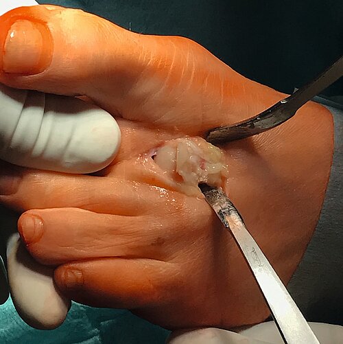 cme_abb_15_a.jpg cme_abb_15_a.jpg