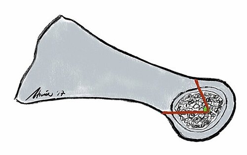 cme_abb_5a.jpg cme_abb_5a.jpg