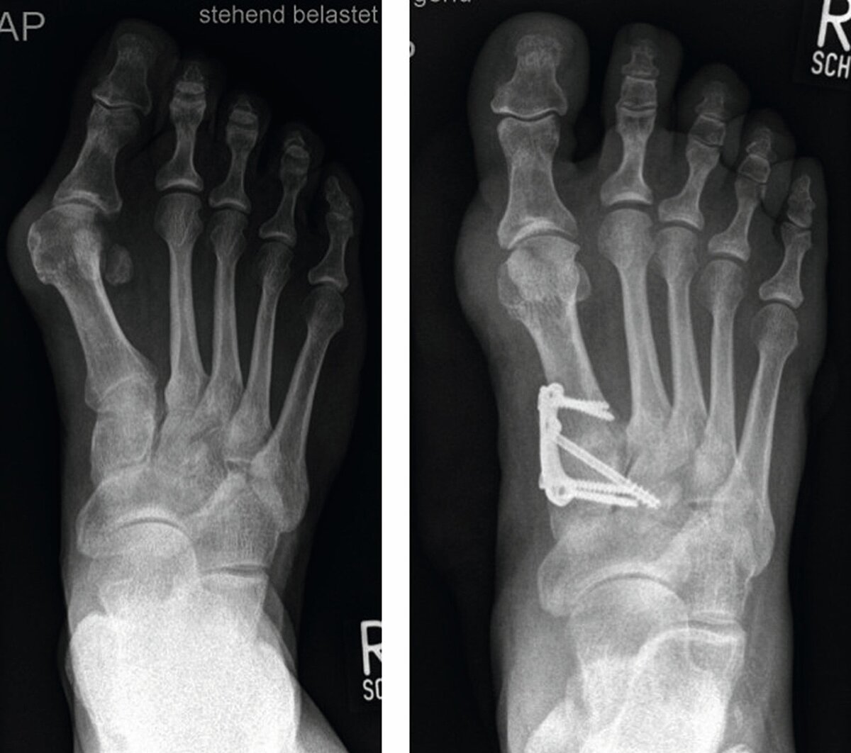 cme_abb_9.jpg cme_abb_9.jpg