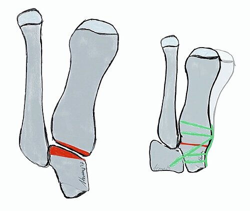 cme_abb_7a_7b.jpg cme_abb_7a_7b.jpg