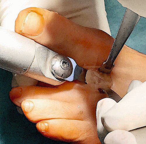 cme_abb_15_c.jpg cme_abb_15_c.jpg