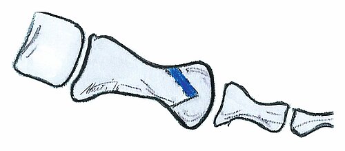 cme_abb_10.jpg cme_abb_10.jpg