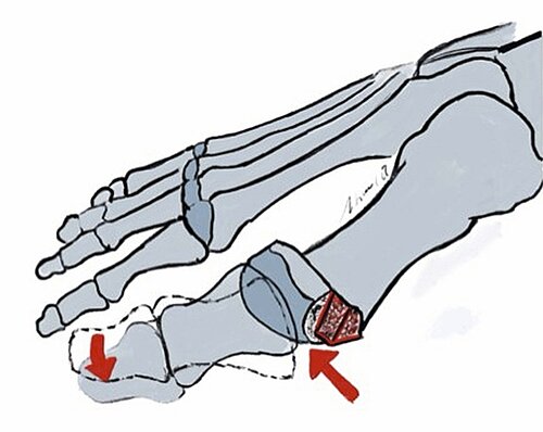 cme_abb_5b.jpg cme_abb_5b.jpg