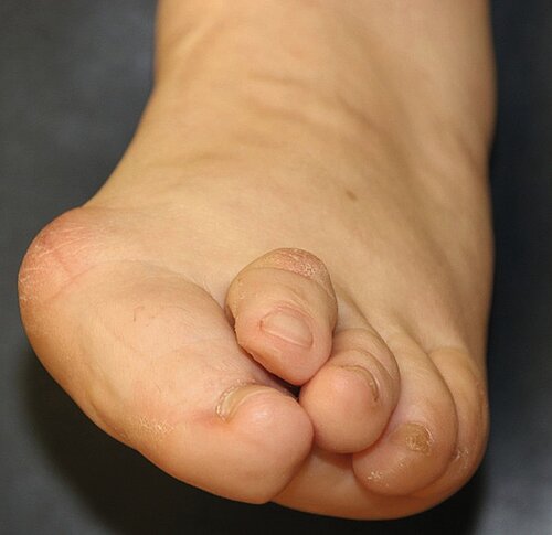 cme_abb_1.jpg cme_abb_1.jpg