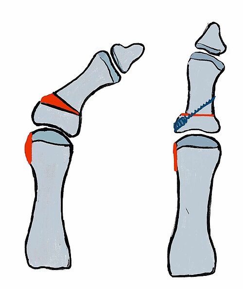 cme_abb_4.jpg cme_abb_4.jpg