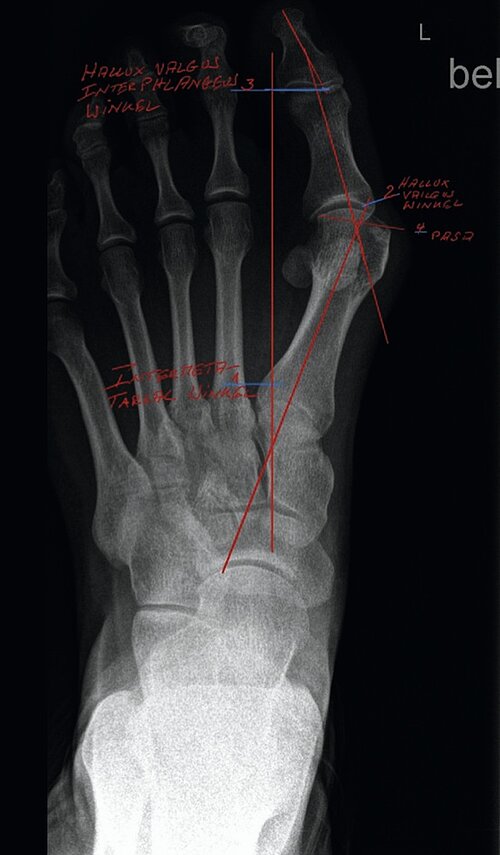 cme_abb_2.jpg cme_abb_2.jpg