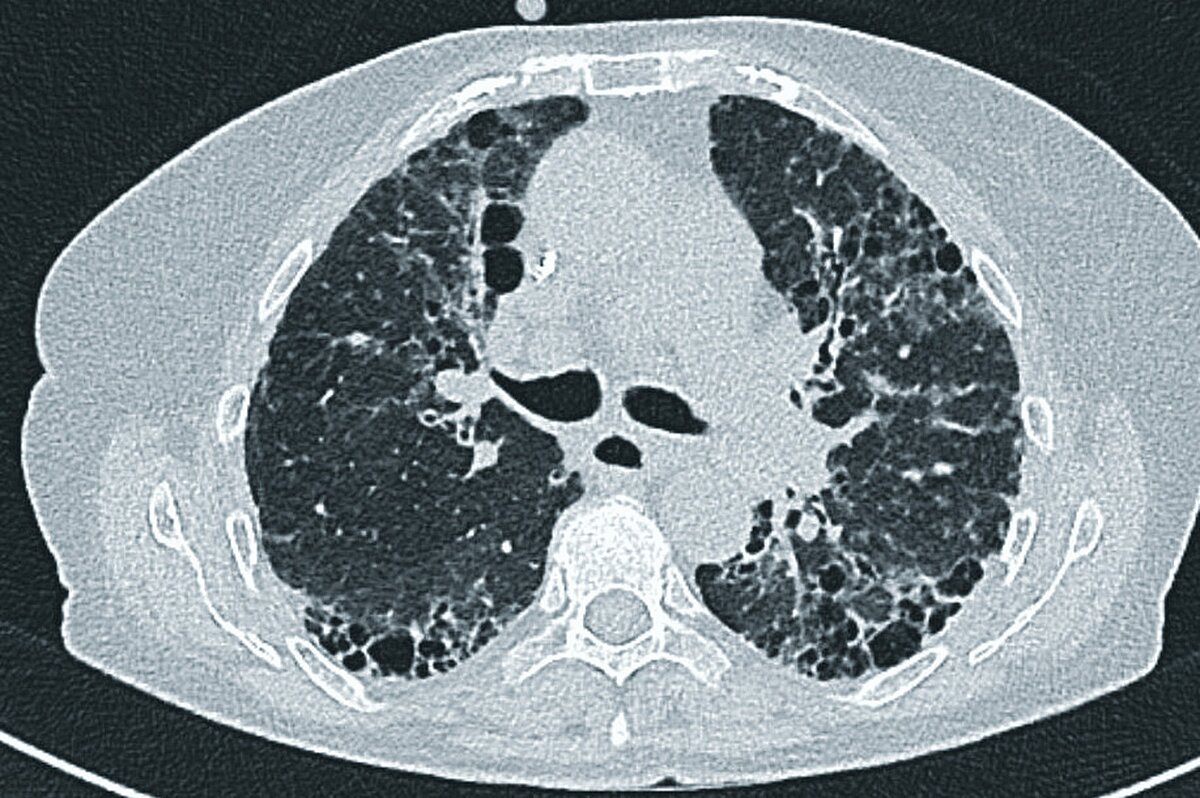 cme_abb_3.jpg cme_abb_3.jpg