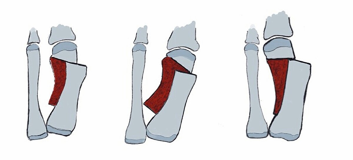 cme_abb_6a.jpg cme_abb_6a.jpg