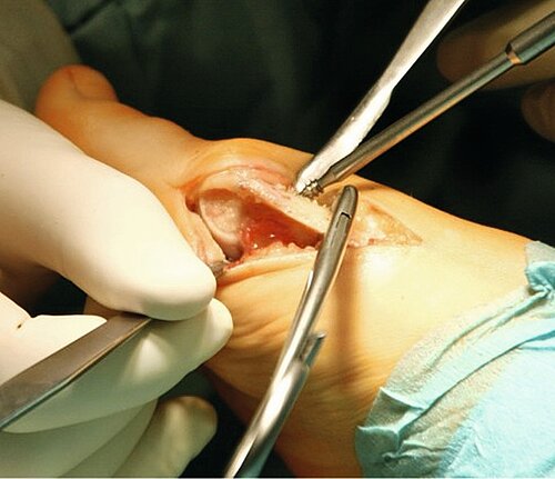 cme_abb_6b.jpg cme_abb_6b.jpg