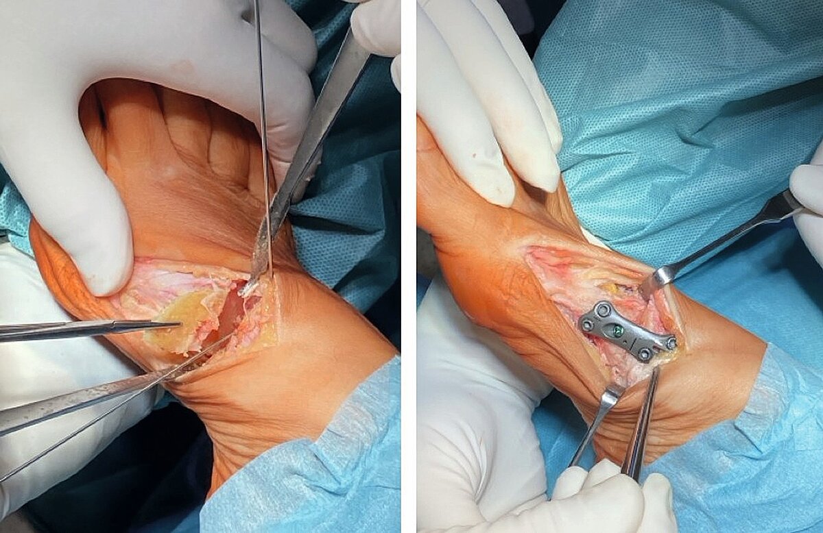 cme_abb_8.jpg cme_abb_8.jpg