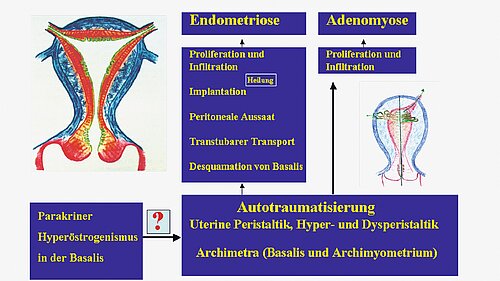endometriose_abb_2.jpg