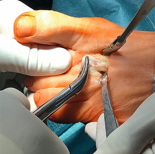 cme_abb_15_b.jpg cme_abb_15_b.jpg