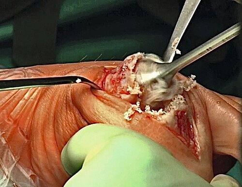 cme_abb_13.jpg cme_abb_13.jpg